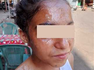 Image for الحبس 6 أشهر لموظفة إدارية تسببت في تشويه وجه طالبة بـمدرسة فيصل