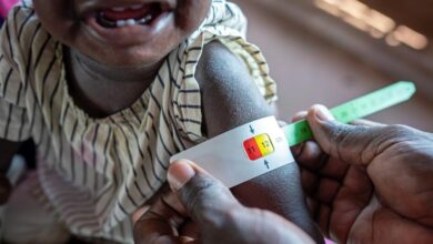 أزمة الجوع في جنوب السودان تهدد ملايين الأشخاص بالمجاعة