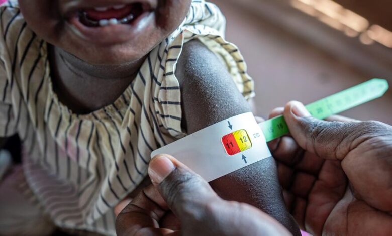 أزمة الجوع في جنوب السودان تهدد ملايين الأشخاص بالمجاعة